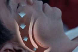 Sleep Apnea: What Is It?