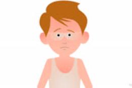 Here's Help: Mild Sunburn in Children