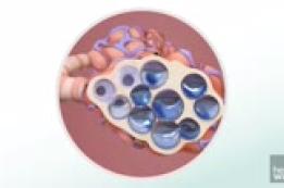 Acute respiratory distress syndrome (ARDS): Fast Facts