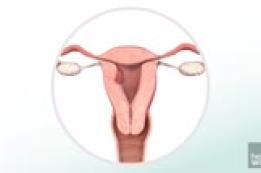 Endometrial cancer: Fast Facts
